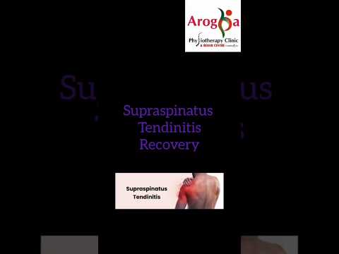 Supraspinatus tendonitis recovery: Arogya physiotips #supraspinatus #shouldermobility