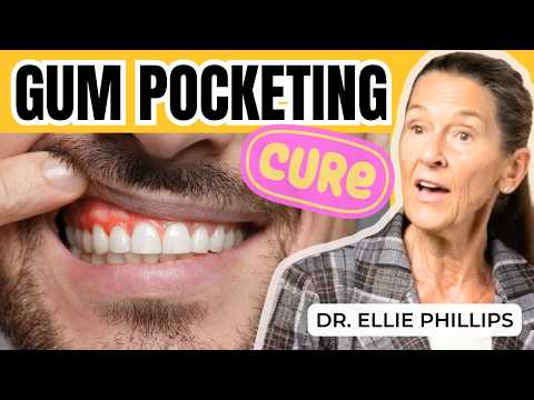 Cure Gum Pocketing to Cure Gum Disease