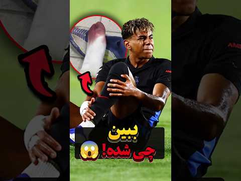چرا پای یامال تو هر بازی خونی میشه؟! 😱⚽ #فوتبال