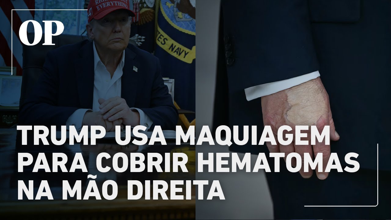 Mão maquiada de Trump levanta novas suspeitas sobre saúde