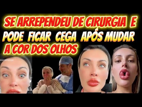 ANDRESSA URACH PODE  FICAR CEGA APÓS MUDAR A COR DOS OLHOS!!😱 QUE LOUCURA É ESSA ?