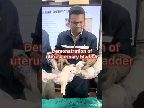 Demonstration of uterus l Dr Umar Khan