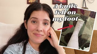 The Story of How I Injured My Foot and Had Surgery (Severed Extensor Tendon)