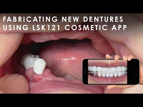 Fabricating New Dentures using the LSK121 Cosmetic App