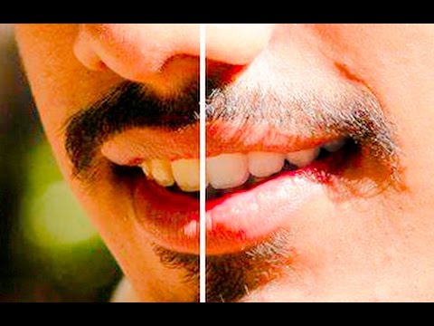 How I Realistically Whitened my Teeth in Photoshop with Detailed and Additional Explanations (Hindi)