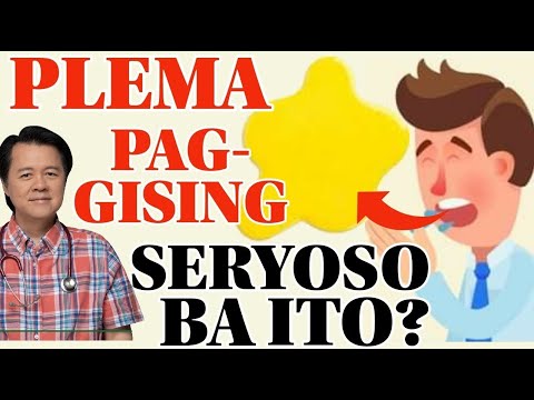 Plema Pag Gising, Seryoso Ba Ito? (Reposted Video)