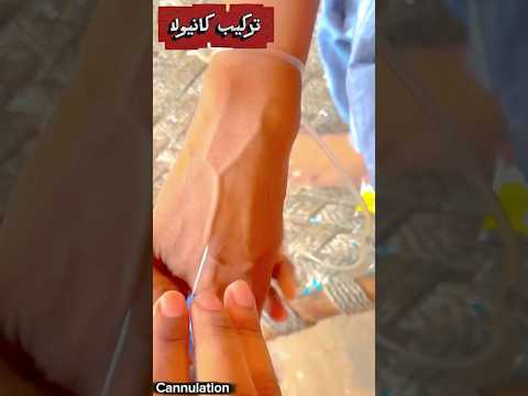 تركيب كانيولا بشكل احترافي 👌#nurse