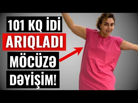 Azərbaycanlı qadın 101 KQ idi, ARIQLADI - Heç kəs onu tanıya bilmədi