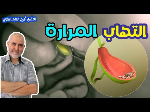 المرارة وتكون الحصوات فيها   -  الدكتور كريم العابد العلوي  -