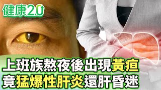 上班族熬夜後出現黃疸 竟猛爆性肝炎還肝昏迷【健康2.0 分段】@tvbshealth20 EP3066-3 20250803 #陳欣湄#韋汝#錢政弘#柳朋馳#羅珮琳#洪素卿#林秋香