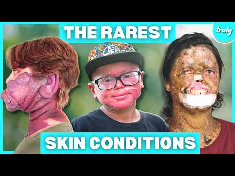 The World's Rarest Skin Conditions | BORN DIFFERENT