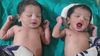 Ashish Kumar Gautam is live Welcome to twins baby after birth