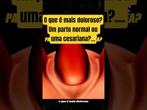 Parto Normal ou Cesárea: Qual é Mais Doloroso? Entenda a Diferença na Dor e Recuperação! #shorts
