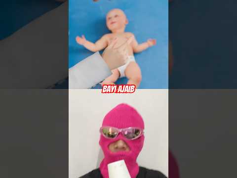 Bayi ajaib hidup lagi