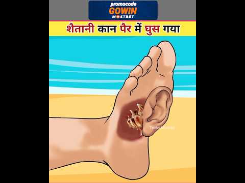 शैतानी कान पैर में घुस गया #asmr #shorts