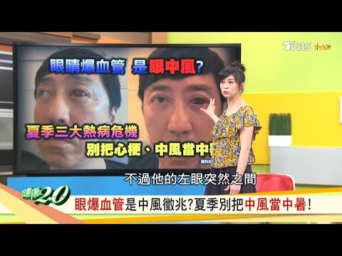 眼爆血管是中風徵兆？夏季別把中風當中暑！ 健康2.0 20190629 (完整版)