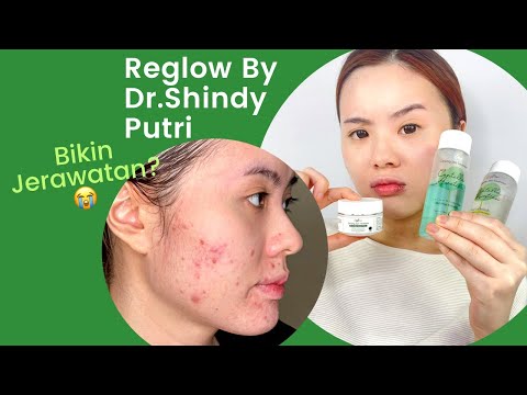 Review Reglow By Dr. Shindy Putri Setelah Pakai 21 Hari (Bikin Jerawatan?)