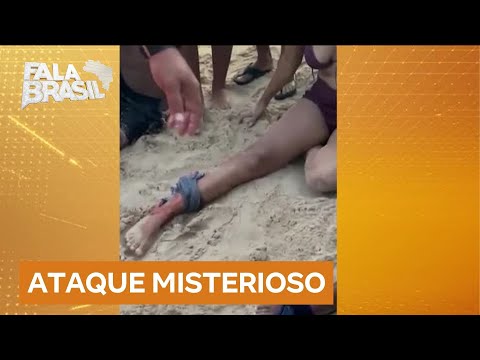 Mordida misteriosa: sete banhistas são atacados em praia do Rio