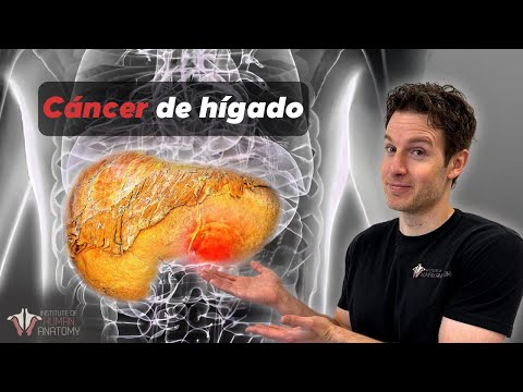 El cáncer de hígado que no viste venir y... ¿Por qué es tan mortal?