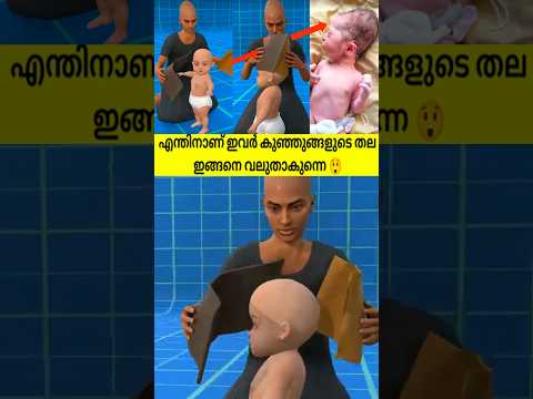 എന്തിനാണ് ഇവർ കുഞ്ഞുങ്ങളുടെ തല ഇങ്ങനെ വലുതാകുന്നെ #malayalamfacts #malayalamshorts #facts #viral