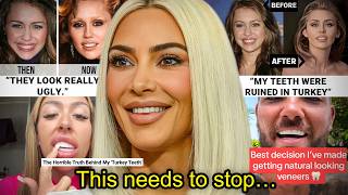 YOUR VENEERS DESTROYED YOUR FACE...