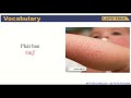 Understanding Rash