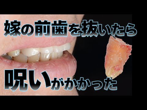 ＃44 なぜ院長は愛想よくできないのか？その理由を驚愕のエピソードから紐解く
