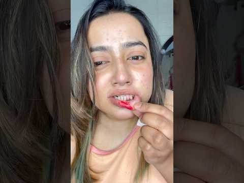 Brush🪥 করতে গিয়ে Lip 👄কেটে গেলো 🩸🤯😱 #minivlog #bengalivideo #shorts #bengalivlog #viralvideo #viral