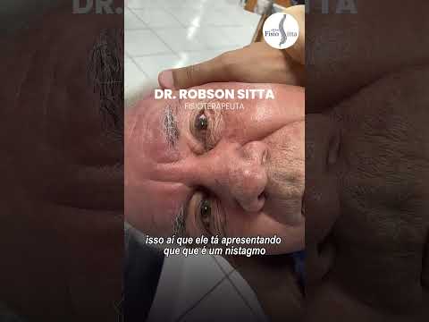 Tontura Giratória? Este Exame Revela se é VPPB | Dr. Robson Sitta