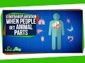 Xenotransplantation and Pig Organs