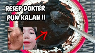 LAGI VIRAL!! ATASI SENDIRI FLEK HITAM DI WAJAHMU !!