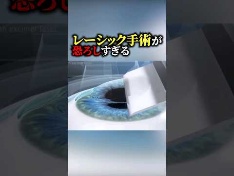 【恐怖】レーシック手術が恐すぎる #おもしろ #海外の反応
