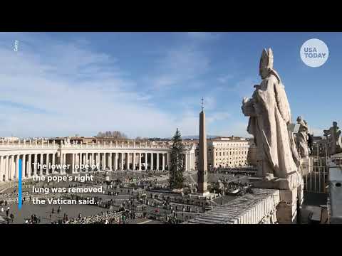 Pope Leo diagnosed with lung cancer after 'successful' surgery