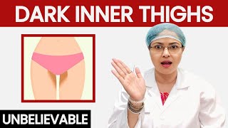 Dark Inner Thighs| क्यों होती हैं जांघें काली, क्या करें?