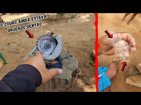 MEU PAI SE ACIDENTOU FEIO COM A SERRA MARMORE E QUASE PERDEU OS DEDOS, VAMOS TER QUE PARAR A OBRA