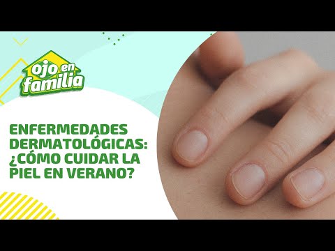 Enfermedades dermatológicas ?☀ ¿Cómo cuidar adecuadamente la piel en verano?