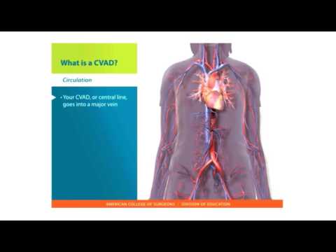 Central Lines Skills: What is a CVAD