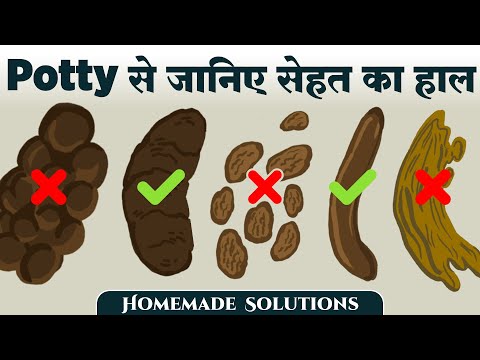 12 ज़रूरी बातें जो हमारा मल बताता है हमारी सेहत के बारे में | Things Stool Says About Your Health