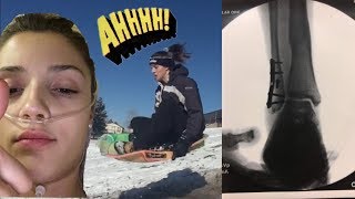 Broken Ankle Sledding Accident ON VIDEO