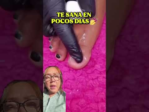 Miren este tip casero #tips #uñas #hongo #viral