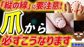 【危険】がん.感染症.栄養失調..知らないと後悔する「爪」の超意外な兆候。色.形.線..爪は内臓の不調を表す鏡だった。水虫を放置した末路は。何科を受診すべき？予防法・対処法はあるのか。医師が完全解説。
