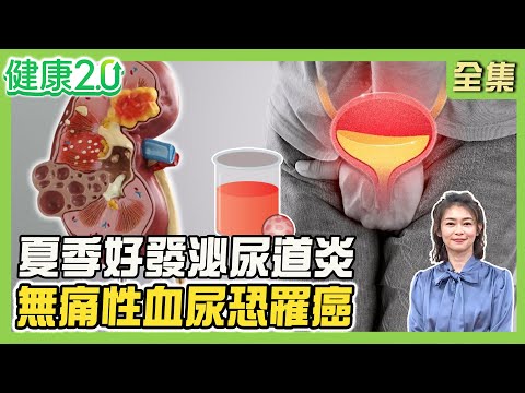 男星拍戲竟血尿罹膀胱癌開刀3次！無痛血尿恐得尿路腫瘤 從形狀看腎臟、膀胱問題！夏季好發泌尿道炎 3款蔬果水助排尿！健康2.0 20250629【完整版】#鄭凱云#陳建良#歸家豪#趙函穎#彥寬#芳瑜