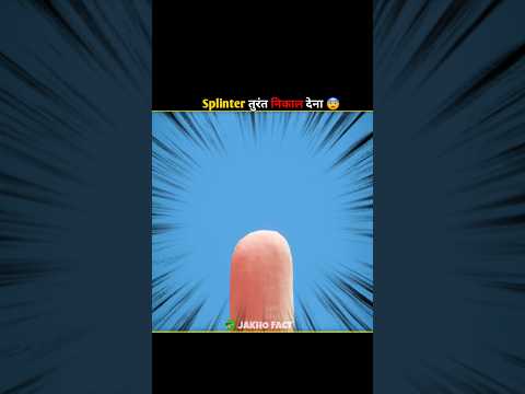 Remove Splinter Immediately 😧 #shorts #animation #amazing