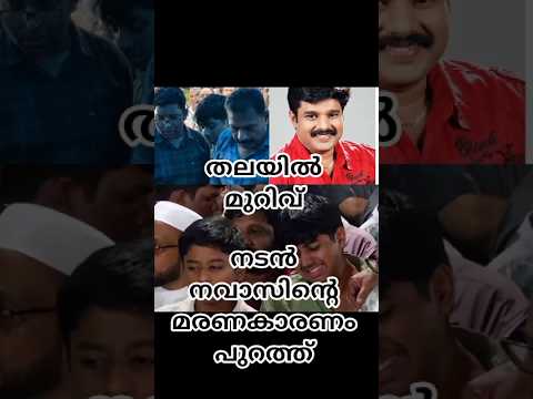 തലയിൽ മുറിവ് നടൻ നവാസിന്റെ മരണ കാരണം പുറത്ത്