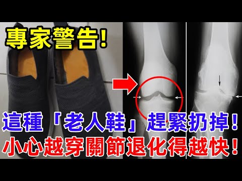 專家警告：這種「老人鞋」趕緊扔掉！越穿關節退化越快！很多長輩都在穿！