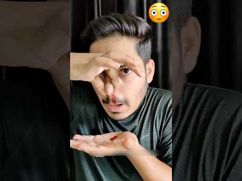 Nose se blood aagya😳😱 || #song #shortsfeed #youtubeshorts #trendingshorts