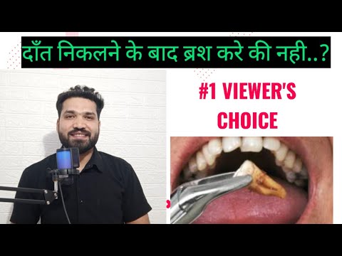 #1 VIEWER'S CHOICE, दाँत निकलवाने के बाद ब्रश कर सकते है क्या??