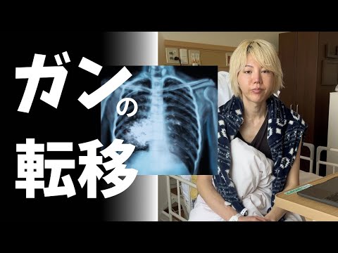 癌の転移とは何か？体験談を交えながらお話します。