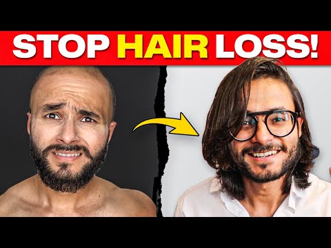 How to Stop Hair Loss (For Indians 🇮🇳)