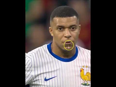 Mbappé Rare Moments 🐸